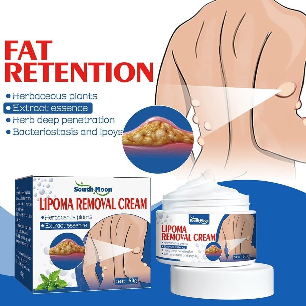 Herbal Lipoma Removal Cream & Spray | Non-Surgical Lump & Fat Knot Relief Ointment
